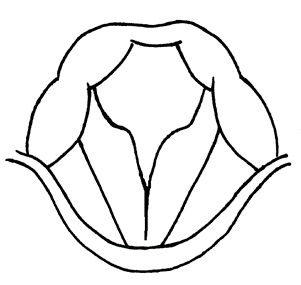 ポリープ様声帯のアイキャッチ画像