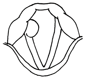 喉頭肉芽腫のアイキャッチ画像