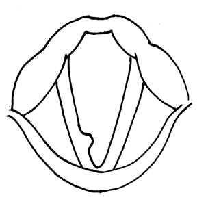 声帯ポリープのアイキャッチ画像