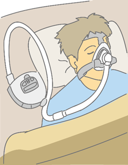 睡眠時無呼吸症候群の治療（CPAP治療について）のアイキャッチ画像